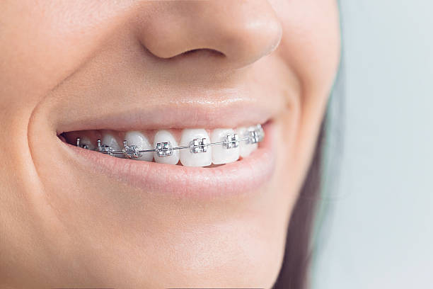 Best Traditional Braces  in Cordova, NC